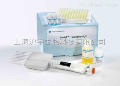 人乙型肝炎病毒X蛋白相互作用蛋白(HBXIP)ELISA试剂盒科研-上海沪宇生物科技